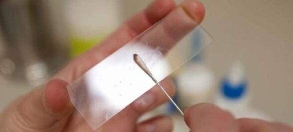 Skrāpēšana pēc tārpu olām